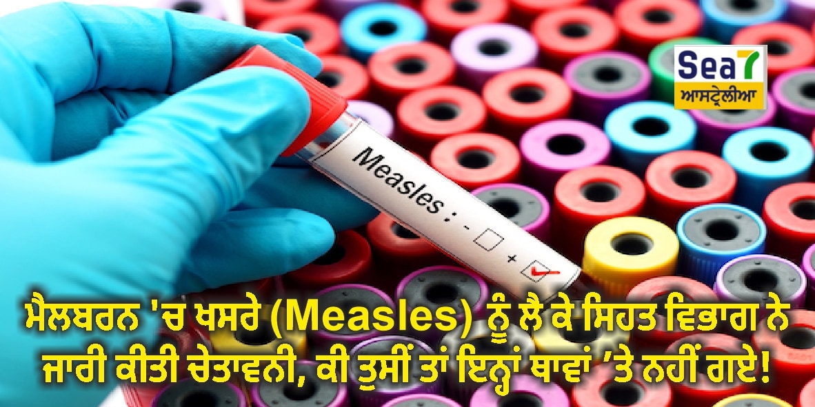 Measles